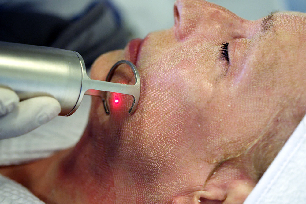 Le laser CO2 chez Claris Clinic