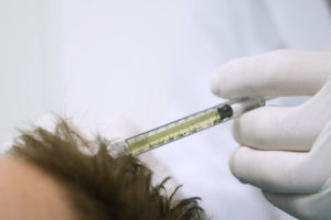 PRP hair treatment