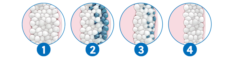 les étapes de cryolipolyse