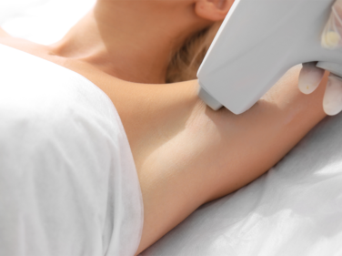 Le laser épilatoire chez Claris Clinic