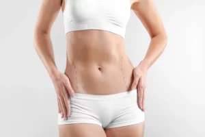 Liposuction