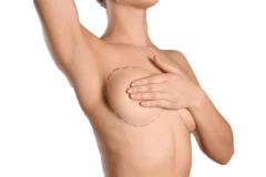 Chirurgie mammaire