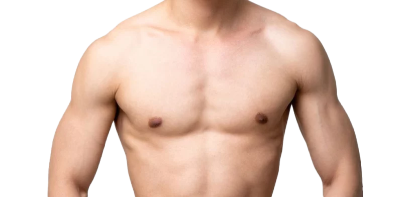 Gynécomastie
