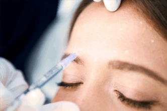 Une personne, les yeux fermés, reçoit une injection cosmétique au front. De petits points blancs sont visibles sur la peau. Des mains gantées tiennent délicatement la seringue et la tête de la personne.