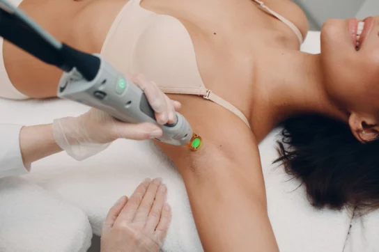 Epilation laser