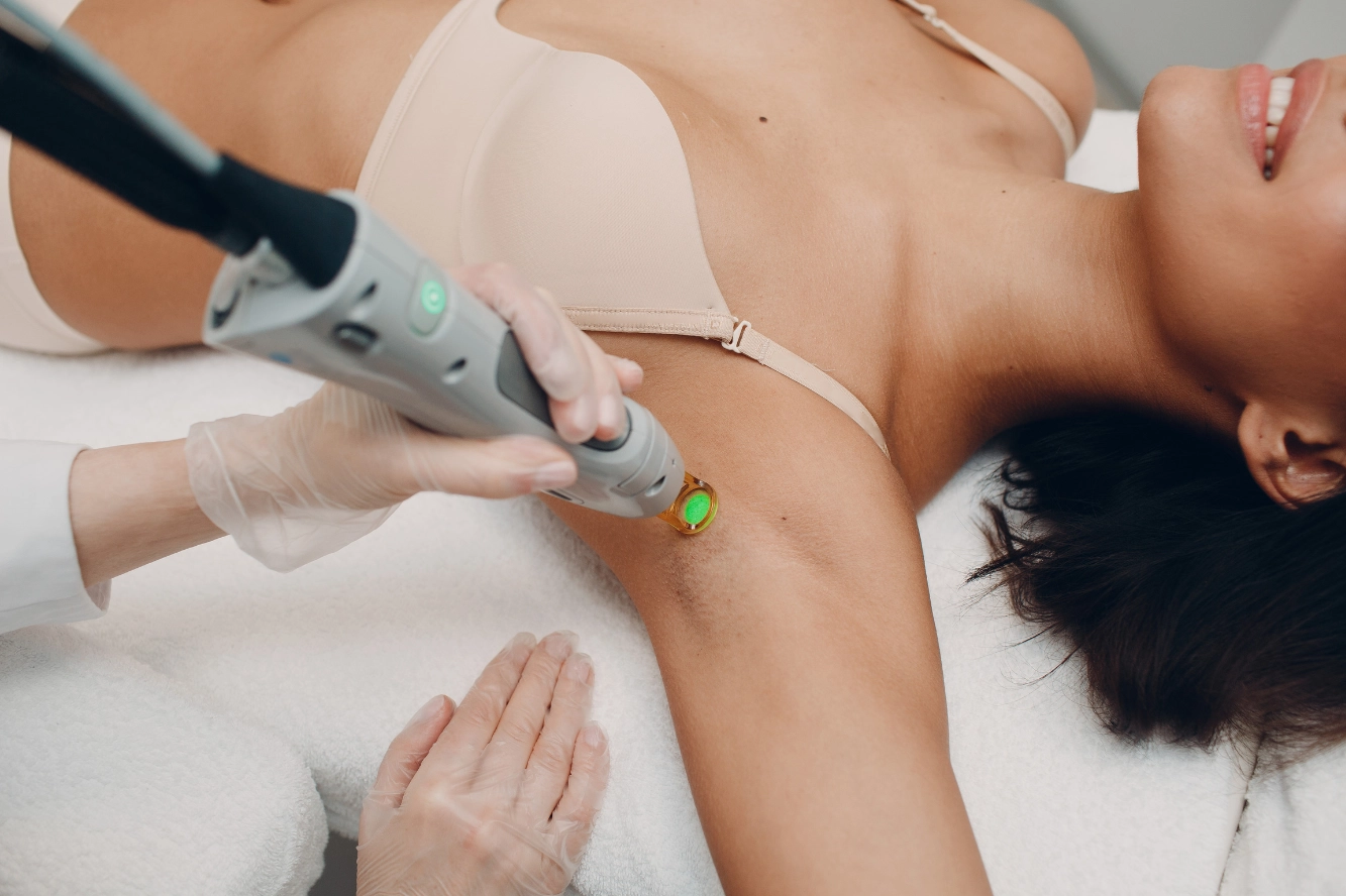 Laser hair removal