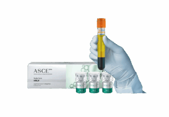 PRP Exosomes