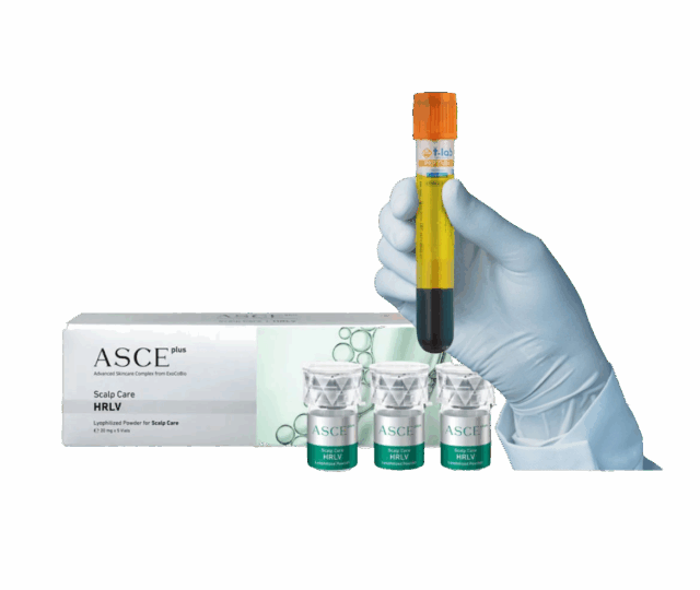 PRP Exosomes