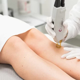 Epilation laser