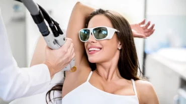 Epilation laser