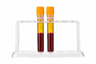 PRP tubes