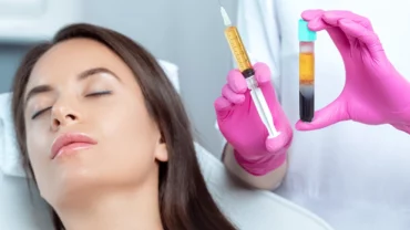 Vampire Lift Claris Clinic