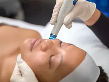 Traitement HydraFacial® pour peau sensible et acné, adapté aux peaux délicates.