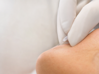 Injection d'acide hyaluronique