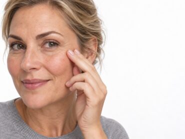 Microneedling peau -Claris Clinic