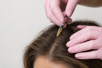 PRP Cheveux - Claris Clinic